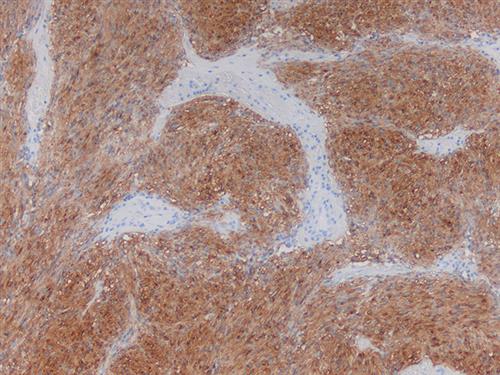 3170B | Control Slides:Immunopathology; CD117, c-Kit